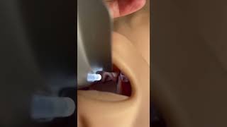 Intubation Tips for Beginners Part 3