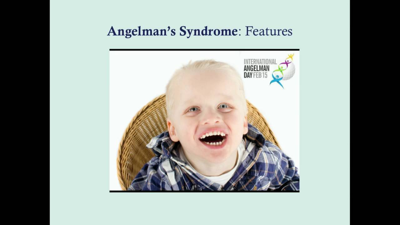 Angelman's Syndrome - CRASH! Medical Review Series - YouTube