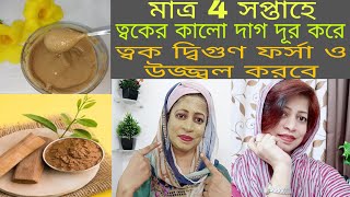 মাত্র চার সপ্তাহের নিখুঁত সুন্দর উজ্জ্বল ত্বক পেতে ব্যবহার করুন|স্বর্ণ উজ্জ্বল ত্বক পেতে ম্যাজিক ফেস