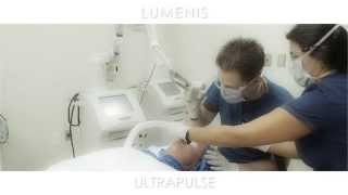 UltraPulse - Procedure Video | Lumenis