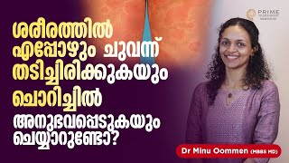 Urticaria Malayalam | ശരീരത്തില്‍ എപ്പോഴും ചുവന്ന് തടിച്ചിരിക്കുകയും ചൊറിച്ചിലും ഉണ്ടാവാറുണ്ടോ