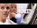 TODDLER BREAKS ARM IN TWO PLACES AT LEGOLAND ON VACATION | BOTH ARM BONES BROKEN