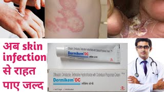 Dermikem-OC Face Cream | डर्मीकेम ओसी | Remove Pimples Darkspots \u0026 Acne | Cream for Glowing Face