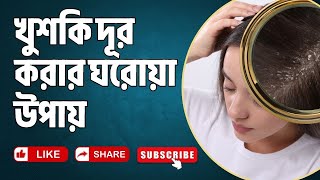 শীতকালে খুশকি দূর করার ঘরোয়া উপায়।Dandruff Solutions