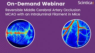 Reversible Middle Cerebral Artery Occlusion MCAO with an Intraluminal Filament in Mice