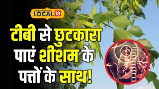 Sheesham Benefits: T.B का समाधान... शीशम के पत्तों का जादुई असर | #local18