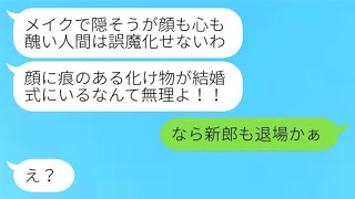 事故の跡がある私を結婚式の前日に招待しなかった親友の婚約者が「化け物は来るな」と発言→彼女に〇〇を伝えた際の反応は...