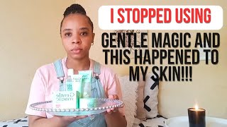 This happened to my skin after I stopped using Gentle Magic Skincare Products.