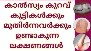 കാൽസ്യം കുറവ് ഈ  ലക്ഷണങ്ങൾ അവഗണിക്കരുത് |calcium  deficiency | മലയാളം