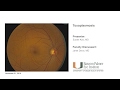 Bascom Palmer Grand Rounds - Toxoplasmosis