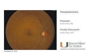Bascom Palmer Grand Rounds - Toxoplasmosis