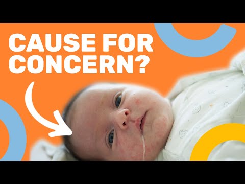 What are the common problems in newborn?