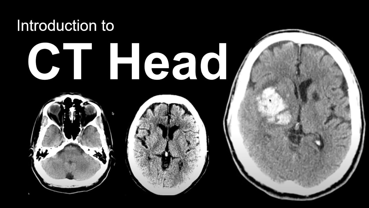 Introduction To Ct Head Approach And Principles Youtube