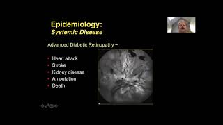 STOP Diabetic Retinopathy: Skills Training in Ophthalmic Photocoagulation