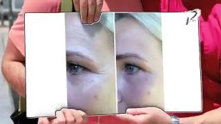 Endlich weg mit der Orangenhaut - Dr. Juchheim Bye Bye Cellulite