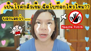 เป็นโรคกลัวเข็ม ฉีดโบท๊อกไหวไหม  ??!!  - NEEDLE POBIA -