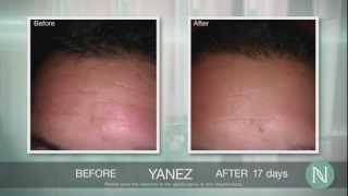 Experience Nerium AD, Best Results for an Anti-aging product, Amazing Work from Home Job