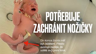 POTŘEBUJE ZACHRÁNIT NOŽIČKY