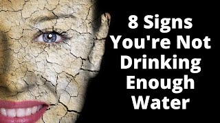 8 Signs of Dehydration (You Are NOT Drinking Enough Water!)