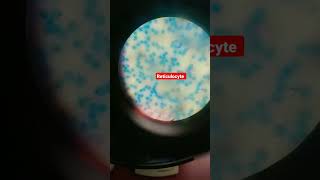 Supravital Stained Slide #mbbs #neet #ytshorts #reticulocyte#reticulum