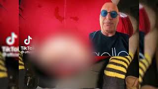 Howie Mandel TikTok Prolapse Full Video