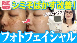 【シミ治療】フォトフェイシャルの効果は？最新機種を徹底解説！