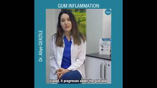 Gingivitis - Dr. Aliye GERZİLE