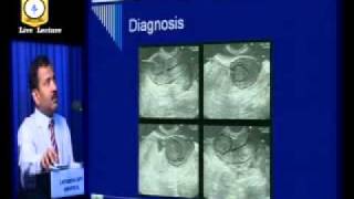 Hysteroscopy