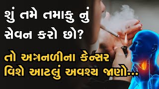 શું તમે તમાકુ નું સેવન કરો છો? તો અન્નનળીના કેન્સર વિશે આટલું અવશ્ય જાણો...