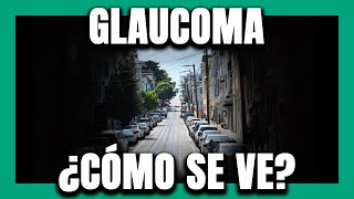 🟢 ¿Cómo ven las PERSONAS con GLAUCOMA? #2