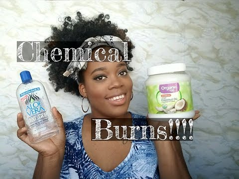 How To Heal Chemical/Relaxer Burn How To Heal Chemical/Relaxer Burn