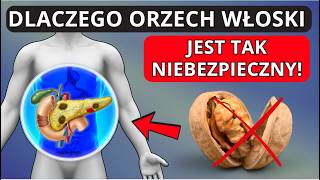 Orzech włoski jest SKRAJNIE PRZECIWWSKAZANY osobom z... może poważnie zaszkodzić!