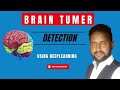 Brain Tumor Detection Using Deep Learning | Brain MRI Images Detection |Python  Project 2022 - 2023