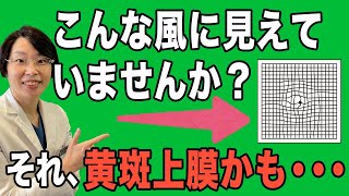 歪んで見える！【黄斑上膜】