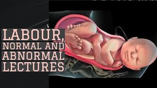 LABOUR lecture 11 PAIN RELIEF IN LABOUR, EPIDURAL ANELGESIA in detail with important points