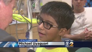 Dr. Max Gomez: Brain Tumor