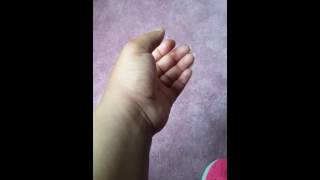 Longer video of Twitching Hand lol