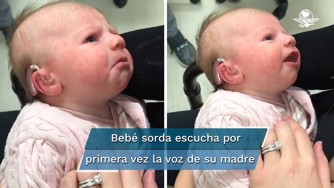 Reacción De Una Bebé Sorda Al Escuchar La Voz De Su Mamá Por Primera ...