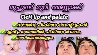 മുച്ചുണ്ടും മുറി അണ്ണാക്കും | Cleft Lip and Cleft Palate Treatment Malayalam | Dr Ajina Dental talk