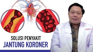 Jantung Koroner: Gejala, Penyebab, dan Cara Mengatasinya | Kata Dokter