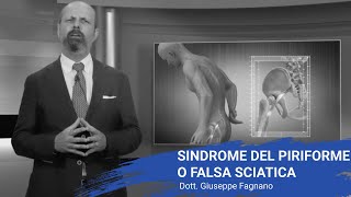 Sindrome del piriforme o falsa sciatica