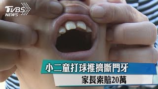 小二童打球推擠斷門牙　家長索賠20萬