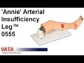 0555 - 'Annie' Arterial Insufficiency Leg™