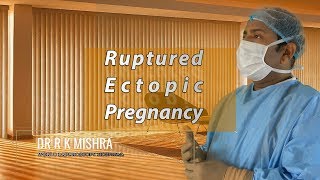 Ruptured Ectopic Pregnancy