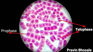 How to identify mitosis stages under microscope | Mitosis Slide | Prophase | Metaphase | Anaphase |