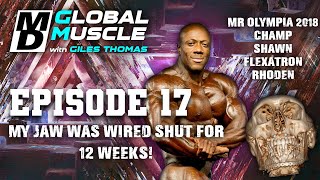 SHAWN RHODEN: My jaw was wired shut for 12 weeks! MD GLOBAL MUSCLE CLIPS S2 E17