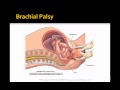 USMLE COMLEX Board Review of Pediatric Birth Injuries