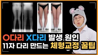 O다리 X다리 발생 원인과 11자 다리 만드는 체형교정 꿀팁