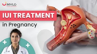 How to Get Pregnant With IUI? | IUI Procedure, Cost and Success Rate | Fertility Treatment | Mylo