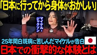 【海外の反応】「日本人は全員狂ってる」25年間白斑病に苦しんだマイケルが告白…日本での衝撃的な体験とは